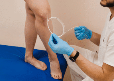 Laser Endovenoso Evlt Napoli
