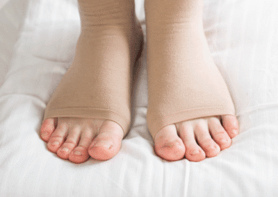 Insufficienza Venosa Napoli