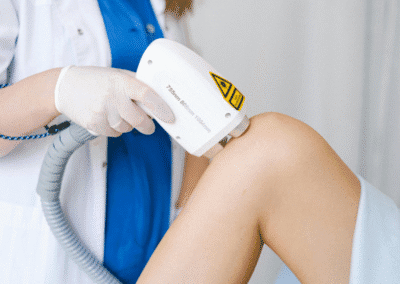 Laser Endovenoso Evlt Napoli