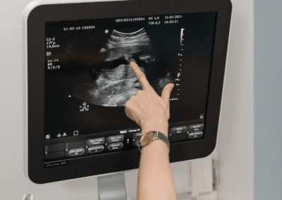 Ecocolordoppler Napoli