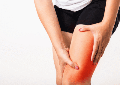 Insufficienza Venosa Napoli